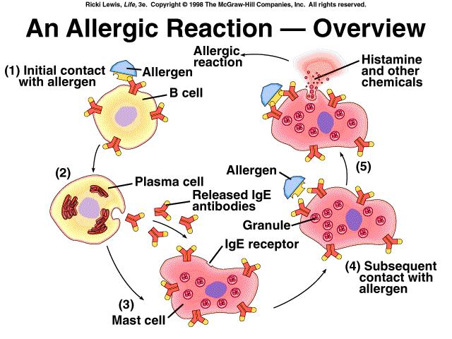 histamine allergy