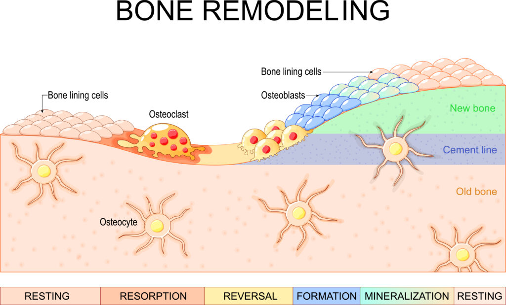 Bones remodel to remain healthy. It's a balance between the breakdown by osteoclasts and the rebuilding by osteoblasts