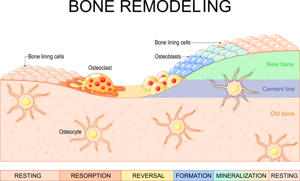 Throughout life our bones remodel if given nutritional support in vitamin D3, K2, calcium, phosphorous, collagen, and others