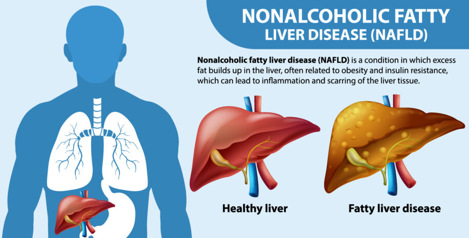 Healthy liver vs the beginnings of an unhealthy liver